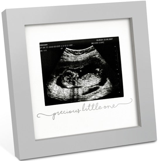 Solo Baby Sonogram Picture Frame
