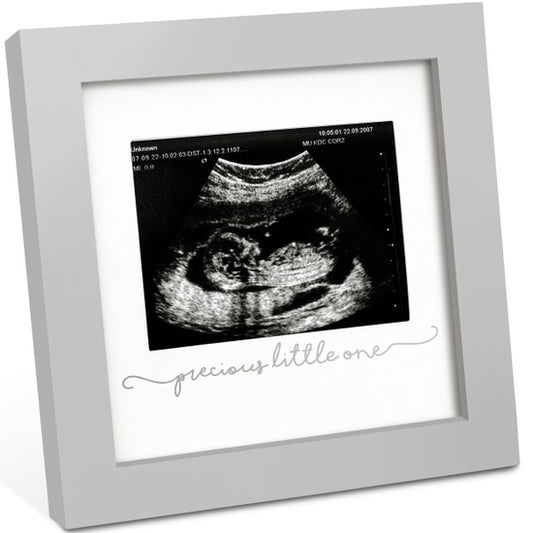 Solo Baby Sonogram Picture Frame